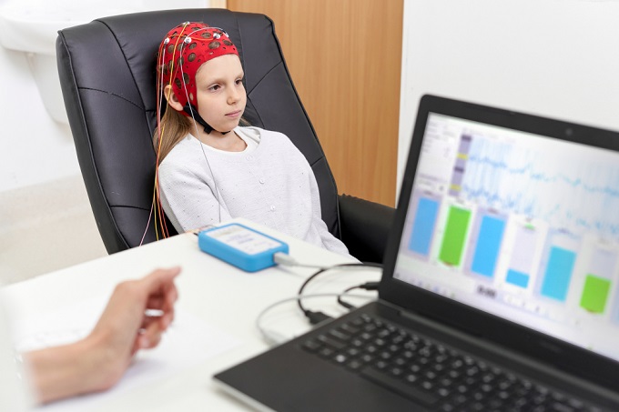 decoding-neuromodulation-asd-treatment-insights